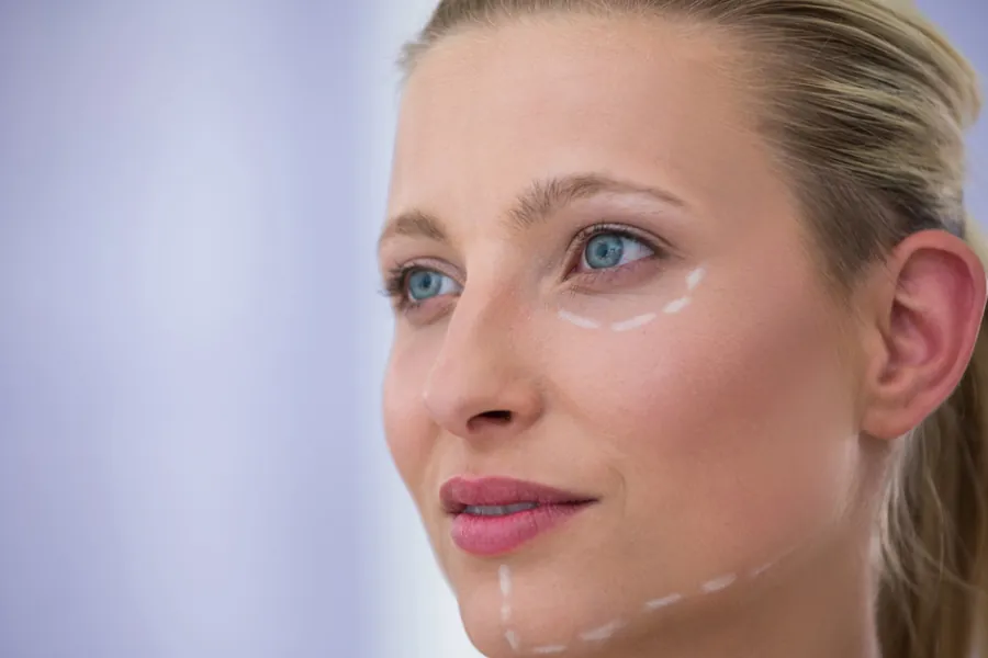 Lifting sem Cirurgia: Técnicas Modernas para Rejuvenescimento Facial