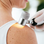 Exérese de Lesões Cutâneas | Dra. Letícia Fachinelli