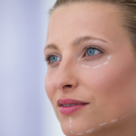 Lifting sem Cirurgia | Dra. Letícia Fachinelli