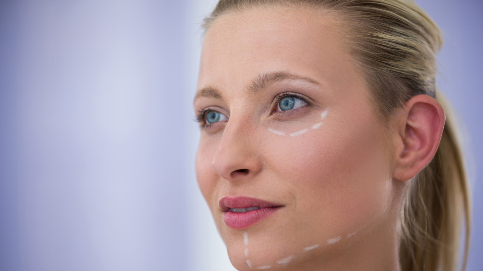 Lifting sem Cirurgia | Dra. Letícia Fachinelli